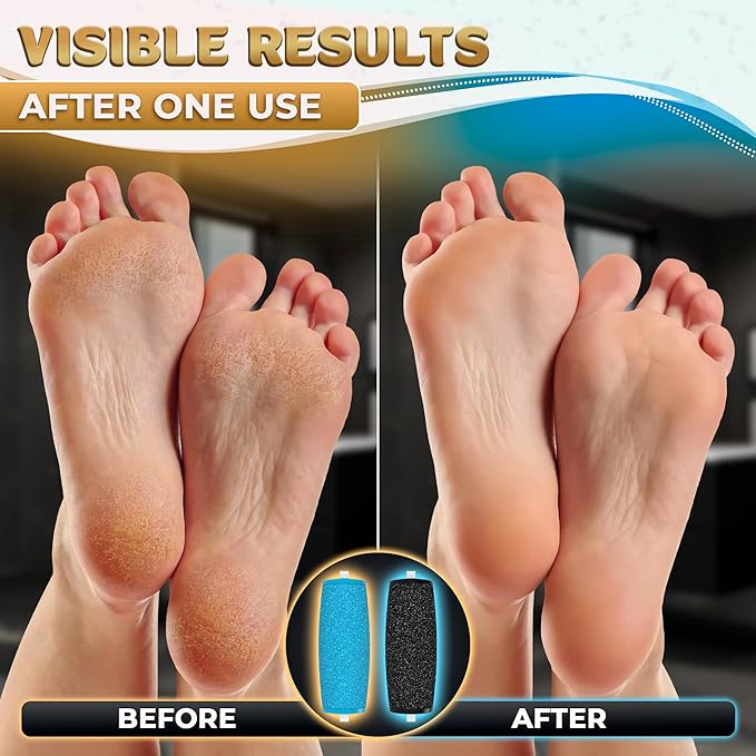 11 Pcs Replacement Rollers for Electric Foot Callus Remover Tool - Image 7