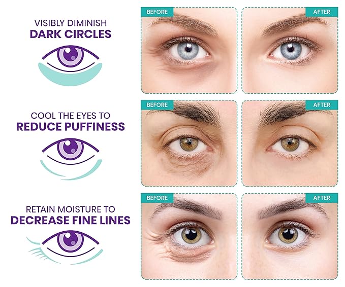 Stylia Under Eye Patches for Puffy Eyes and Dark Circles - Image 4