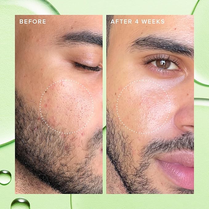 Farmacy 2% Salicylic Acid Toner - Image 5