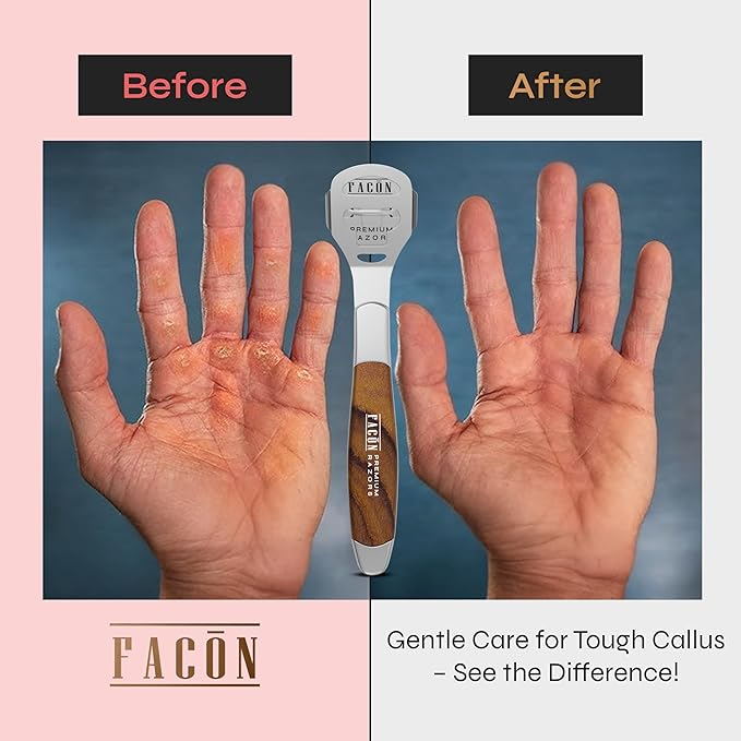 Facón Professional Callus Shaver Remover - Image 4