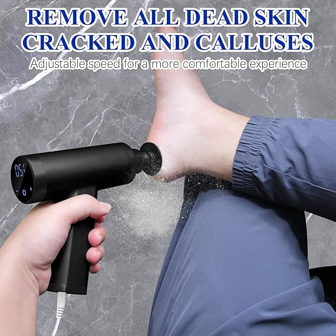 Upgraded Electric Callus Remover - Image 2