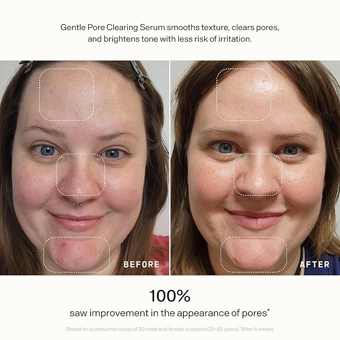 VERSED Skin Refine Gentle Pore Clearing Serum | Exfoliating Facial Serum - Image 12