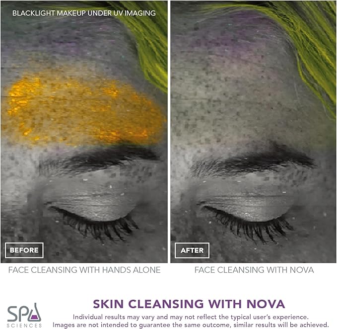 Spa Sciences - NOVA - Sonic Cleansing Brush - Image 6