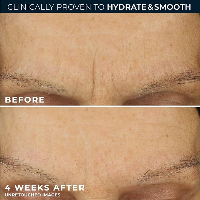 RoC Retinol Correxion Max Daily Hydration Anti-Aging Face Moisturizer - Image 5