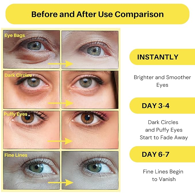 Collagen Under Eye Patches - Image 2