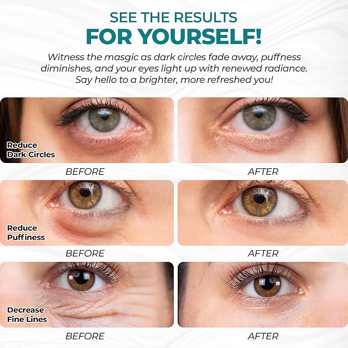 Eye Patches for Reducing Puffy Eyes and Dark Circles, Wrinkles | Eye mask - Image 5
