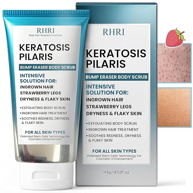 KP Bump Eraser Body Scrub with 10% AHA | Keratosis Pilaris Treatment | Bump by RidaHairResearchInstitute