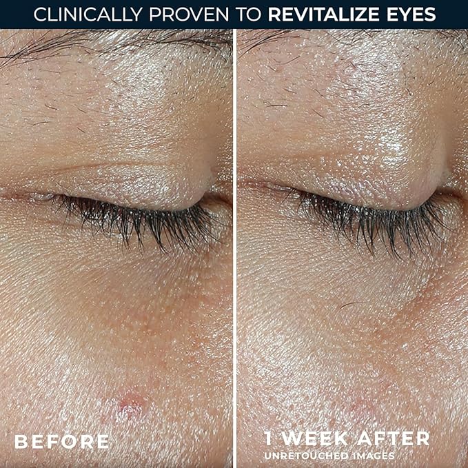 RoC Multi Correxion Revive + Glow Eye Balm - Image 4