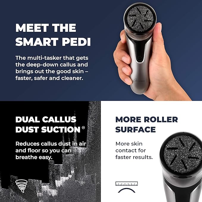 Electric Foot Callus Remover - Image 2