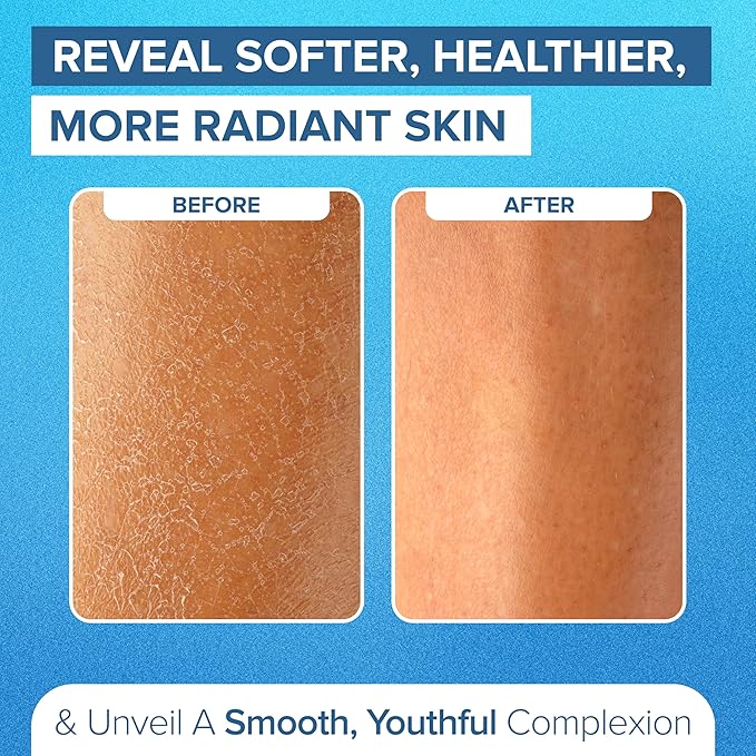 DEEP Exfoliation Body Exfoliating Glove - Image 5